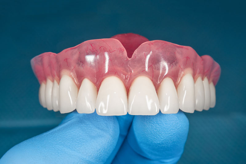 full-dentures model