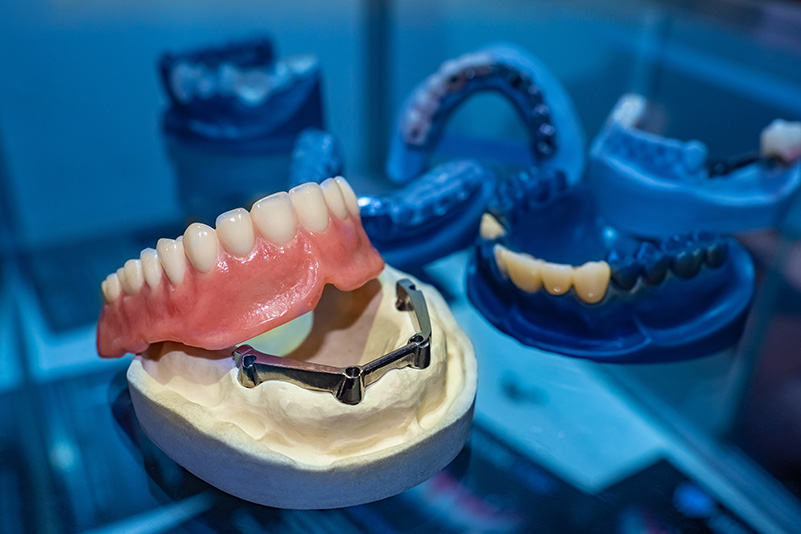 Models of removable implant dentures