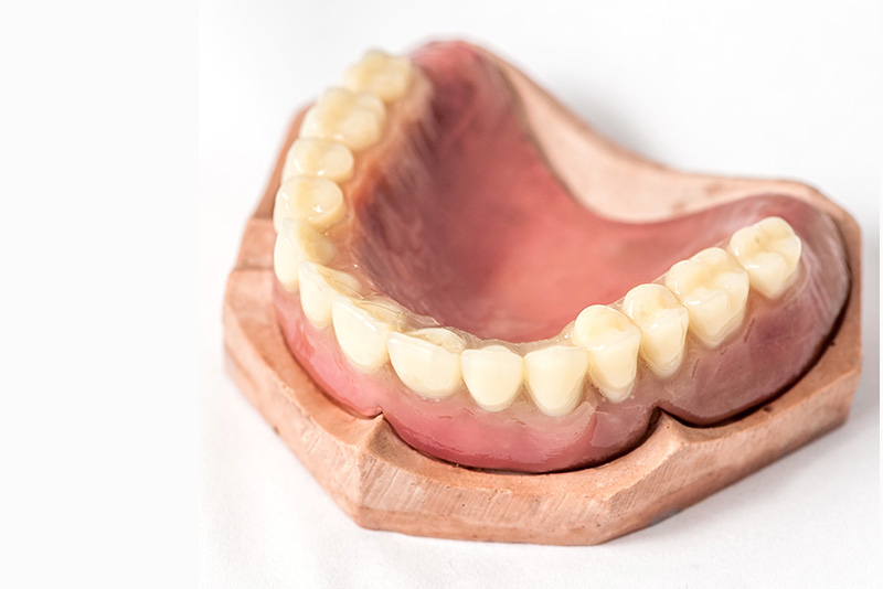 Immediate denture Upper
