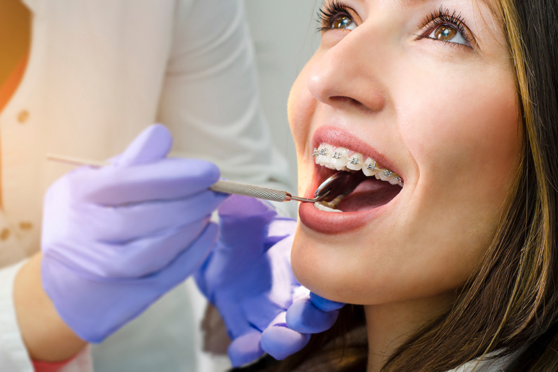 Closeup of beautiful girl on dental braces